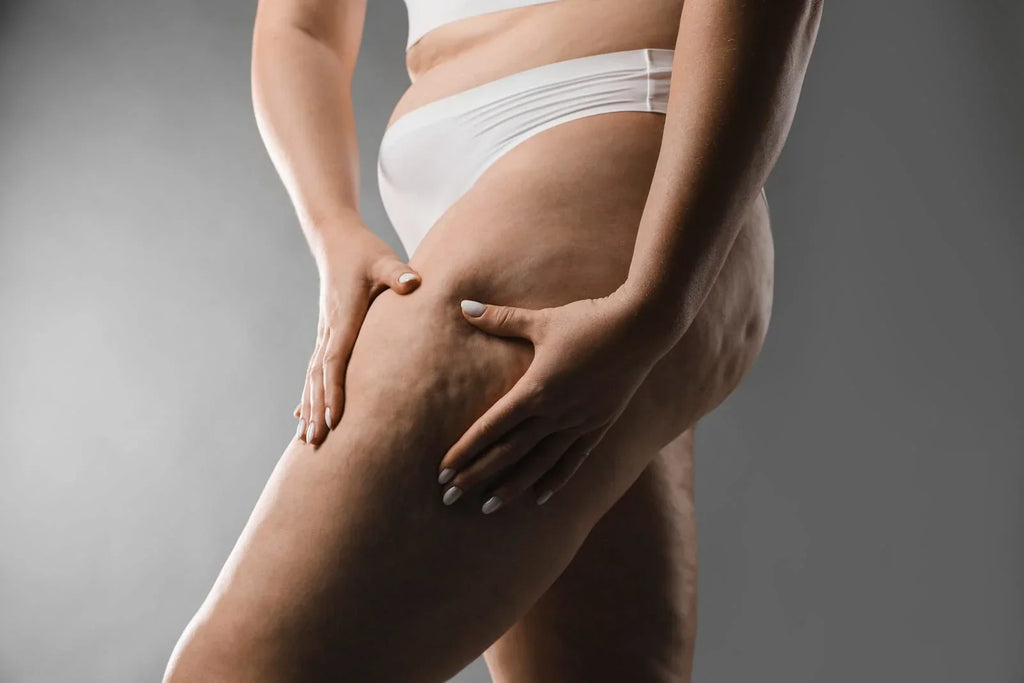 Red Light Therapy for Cellulite: Exploring Its Benefits & Limitations
