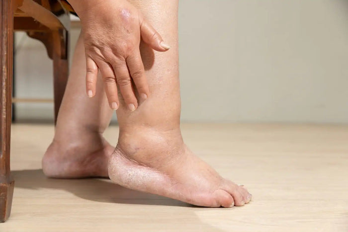 Red Light Therapy for Lymphedema: What Research Says About Swelling, Circulation, and Tissue Health