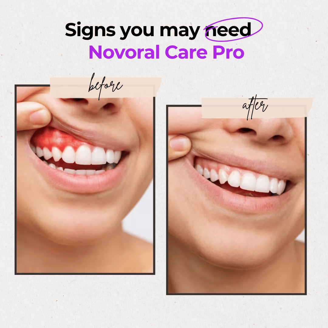 Novaa Oral Care Pro